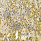 Peptidylprolyl Cis/Trans Isomerase, NIMA-Interacting 1 antibody, A2106, ABclonal Technology, Immunohistochemistry paraffin image 