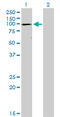 ATPase Sarcoplasmic/Endoplasmic Reticulum Ca2+ Transporting 1 antibody, LS-B4285, Lifespan Biosciences, Western Blot image 