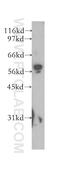 Monoamine Oxidase B antibody, 12602-1-AP, Proteintech Group, Western Blot image 