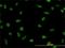 LIM Domain Binding 2 antibody, H00009079-M01, Novus Biologicals, Immunocytochemistry image 