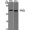 HCK Proto-Oncogene, Src Family Tyrosine Kinase antibody, LS-C383895, Lifespan Biosciences, Western Blot image 