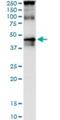 TARBP2 Subunit Of RISC Loading Complex antibody, H00006895-M03, Novus Biologicals, Western Blot image 