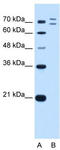 Ring Finger Protein 168 antibody, TA330515, Origene, Western Blot image 