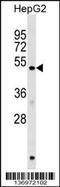 HERP antibody, 59-043, ProSci, Western Blot image 