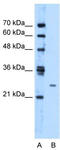 Transmembrane Protein 126B antibody, TA331046, Origene, Western Blot image 
