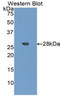 Insulin Like Growth Factor Binding Protein 4 antibody, LS-C292454, Lifespan Biosciences, Western Blot image 