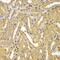 Ubiquitin Conjugating Enzyme E2 Z antibody, GTX32945, GeneTex, Immunohistochemistry paraffin image 