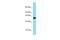 Sperm acrosome membrane-associated protein 3 antibody, A10284, Boster Biological Technology, Western Blot image 