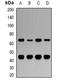 Nuclear Receptor Subfamily 5 Group A Member 2 antibody, orb381921, Biorbyt, Western Blot image 