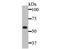 Keratin 5 antibody, NBP2-80435, Novus Biologicals, Western Blot image 