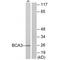 A-Kinase Interacting Protein 1 antibody, A09490, Boster Biological Technology, Western Blot image 