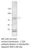 Solute Carrier Family 6 Member 2 antibody, MBS540046, MyBioSource, Western Blot image 