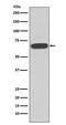 Eukaryotic Translation Initiation Factor 2 Alpha Kinase 2 antibody, M01384, Boster Biological Technology, Western Blot image 