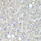 Mucin 16, Cell Surface Associated antibody, STJ112045, St John