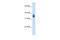 MAGE Family Member A8 antibody, A14572, Boster Biological Technology, Western Blot image 