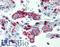 Integrin Subunit Beta 2 antibody, LS-B3720, Lifespan Biosciences, Immunohistochemistry frozen image 