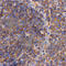 Programmed Cell Death 10 antibody, A2786, ABclonal Technology, Immunohistochemistry paraffin image 
