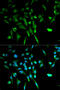 SS-A antibody, 18-413, ProSci, Immunofluorescence image 