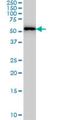 Phenylalanyl-TRNA Synthetase Subunit Alpha antibody, H00002193-M01, Novus Biologicals, Western Blot image 