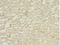 Death Associated Protein Kinase 2 antibody, LS-C369511, Lifespan Biosciences, Immunohistochemistry paraffin image 