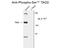 TAO Kinase 2 antibody, GTX82581, GeneTex, Western Blot image 