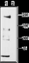 Calcium Voltage-Gated Channel Subunit Alpha1 H antibody, GTX54813, GeneTex, Western Blot image 