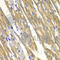 Tyrosinase antibody, A1254, ABclonal Technology, Immunohistochemistry paraffin image 