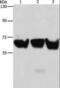 Adrenoceptor Alpha 1B antibody, LS-C406120, Lifespan Biosciences, Western Blot image 