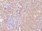ACK1 antibody, 201379-T08, Sino Biological, Immunohistochemistry paraffin image 