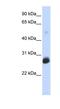 Ring Finger Protein 186 antibody, NBP1-59774, Novus Biologicals, Western Blot image 