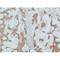 Phosphoinositide-3-Kinase Regulatory Subunit 1 antibody, LS-C387818, Lifespan Biosciences, Immunohistochemistry paraffin image 
