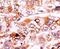 p21 antibody, PA5-12647, Invitrogen Antibodies, Immunohistochemistry paraffin image 