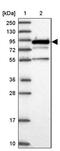 EPS8 Like 2 antibody, PA5-59447, Invitrogen Antibodies, Western Blot image 