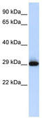 Sushi Domain Containing 3 antibody, TA333507, Origene, Western Blot image 