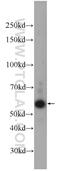 Transmembrane Protein 161A antibody, 24898-1-AP, Proteintech Group, Western Blot image 