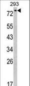 EPS8 Like 3 antibody, LS-C167794, Lifespan Biosciences, Western Blot image 