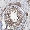 Mediator Complex Subunit 27 antibody, HPA007002, Atlas Antibodies, Immunohistochemistry paraffin image 