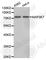 Mitogen-Activated Protein Kinase Kinase Kinase 7 antibody, A0923, ABclonal Technology, Western Blot image 