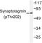 Synaptotagmin 1 antibody, LS-C192168, Lifespan Biosciences, Western Blot image 