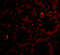 Protein-tyrosine kinase 7 antibody, A02957-1, Boster Biological Technology, Immunofluorescence image 