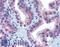 Golgin A2 antibody, LS-B15159, Lifespan Biosciences, Immunohistochemistry paraffin image 