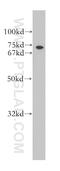 Intestinal Cell Kinase antibody, 13611-1-AP, Proteintech Group, Western Blot image 