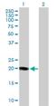 Potassium voltage-gated channel subfamily E member 1 antibody, H00003753-D01P, Novus Biologicals, Western Blot image 