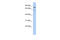 Oxidative Stress Induced Growth Inhibitor 1 antibody, ARP55853_P050, Aviva Systems Biology, Western Blot image 