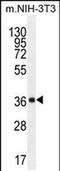 Abhydrolase Domain Containing 17C antibody, PA5-48160, Invitrogen Antibodies, Western Blot image 