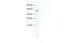 Glypican 3 antibody, GTX47449, GeneTex, Western Blot image 