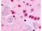 GLI Family Zinc Finger 2 antibody, PA1-28838, Invitrogen Antibodies, Immunohistochemistry frozen image 