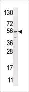 Ubiquitin carboxyl-terminal hydrolase 16 antibody, AP12033PU-N, Origene, Western Blot image 