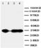 Carbonic Anhydrase 1 antibody, LS-C312588, Lifespan Biosciences, Western Blot image 