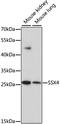 SSX Family Member 4B antibody, A7929, ABclonal Technology, Western Blot image 